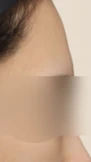 before_image