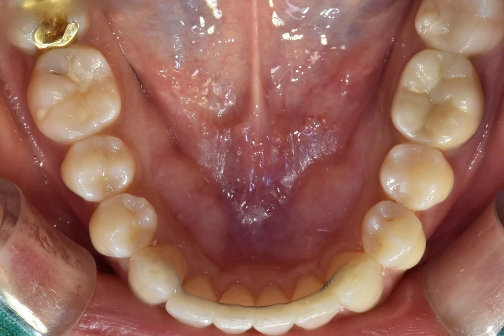 before_image