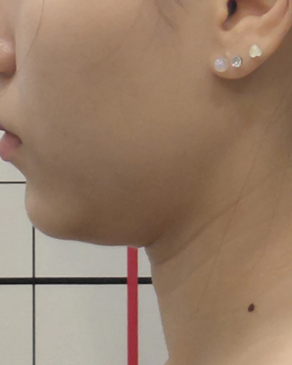 before_image