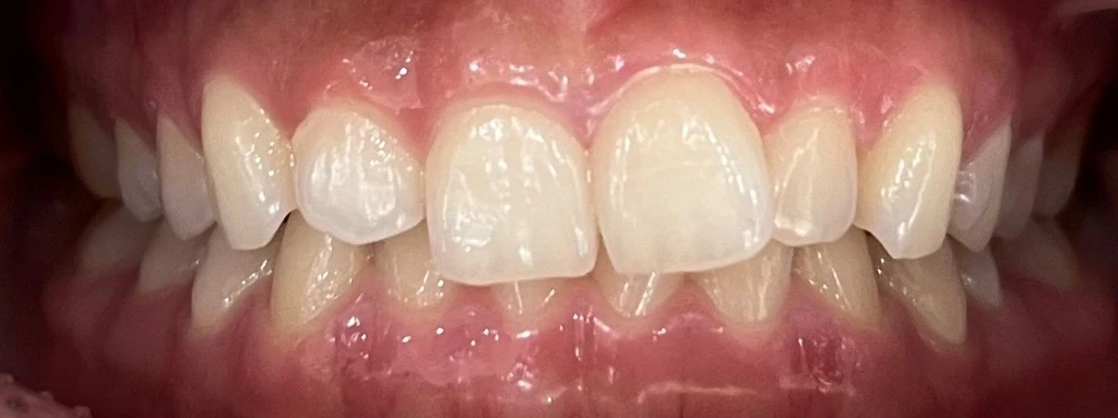 before_image