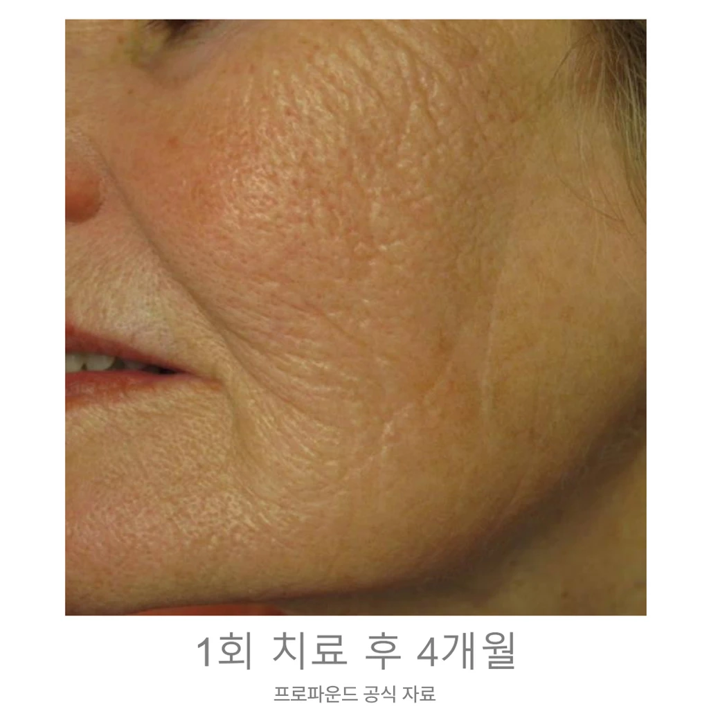 before_image