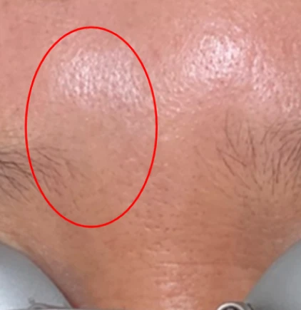 before_image