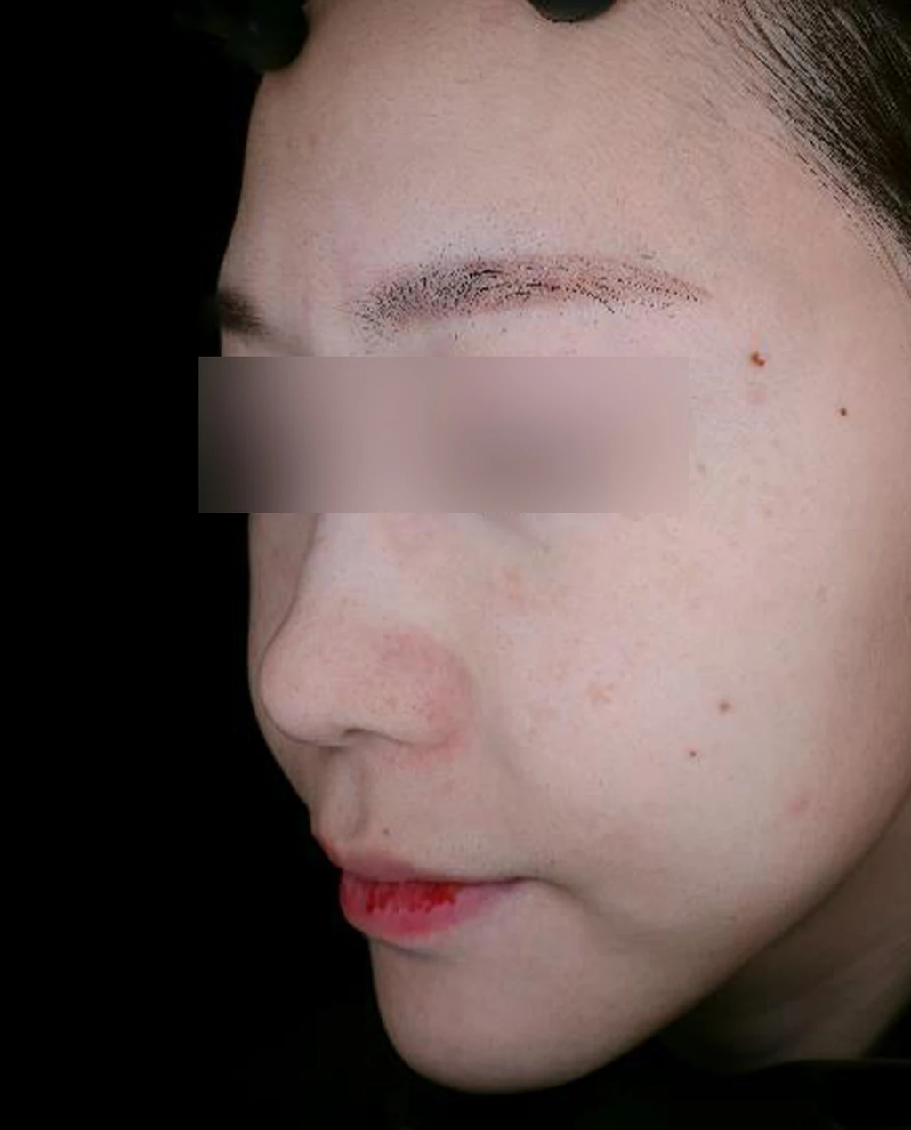 before_image