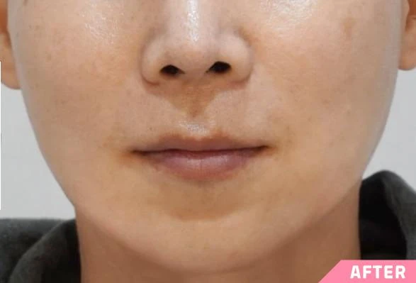 before_image