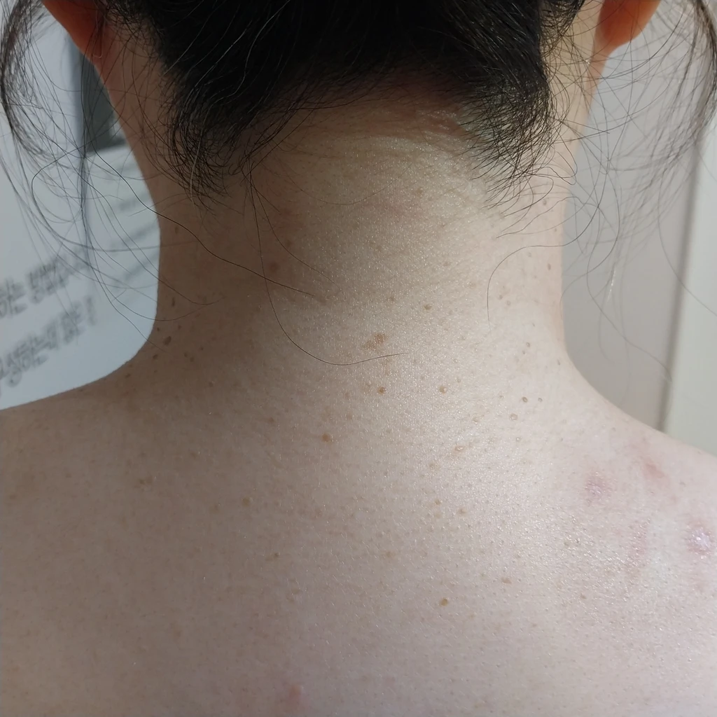 before_image