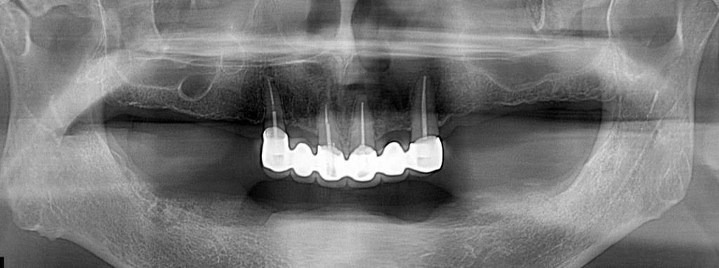 before_image