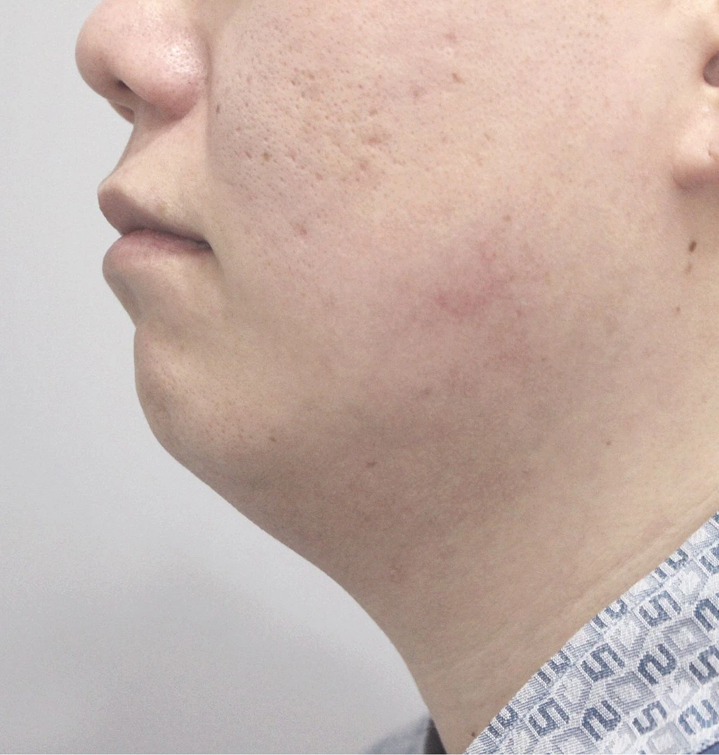 before_image