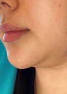 before_image