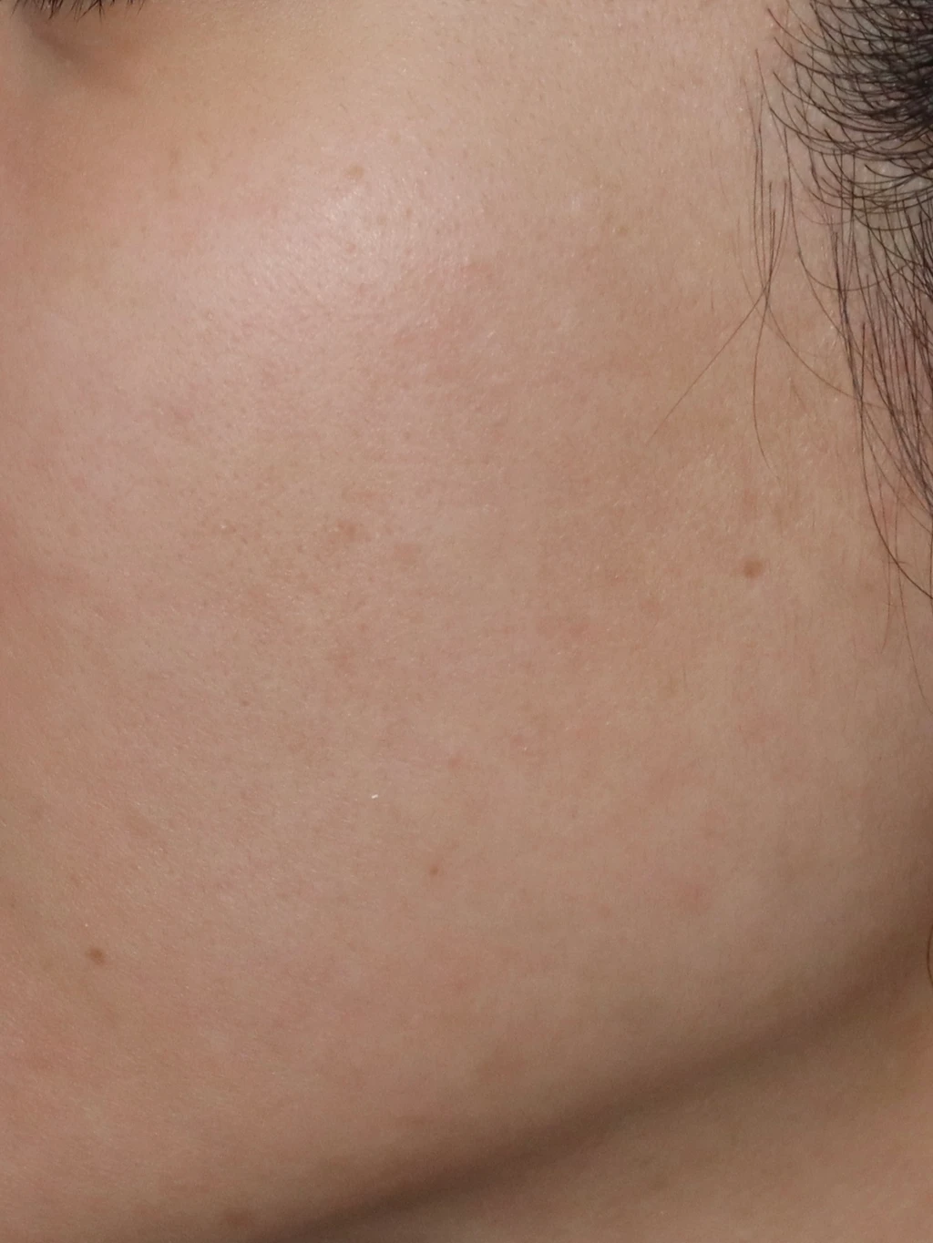 before_image