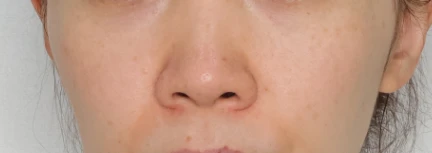 before_image