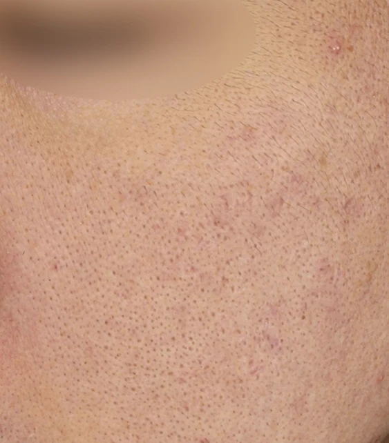 before_image