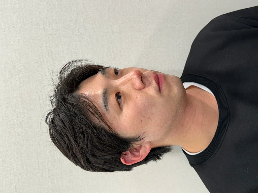 before_image