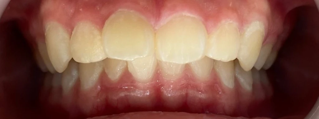 before_image
