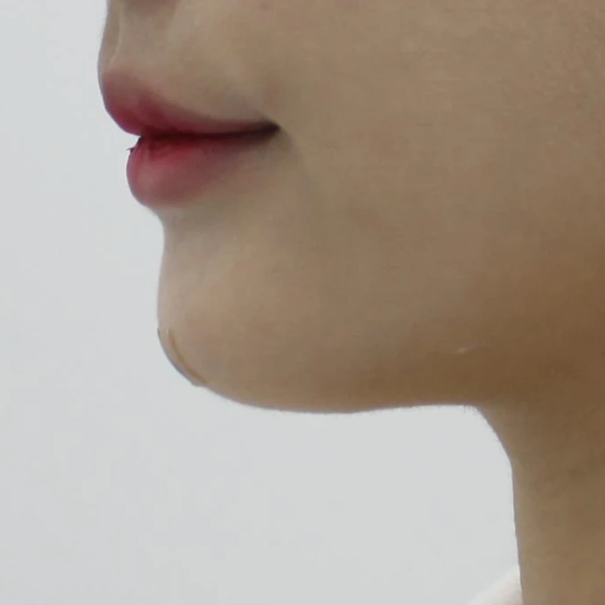 before_image