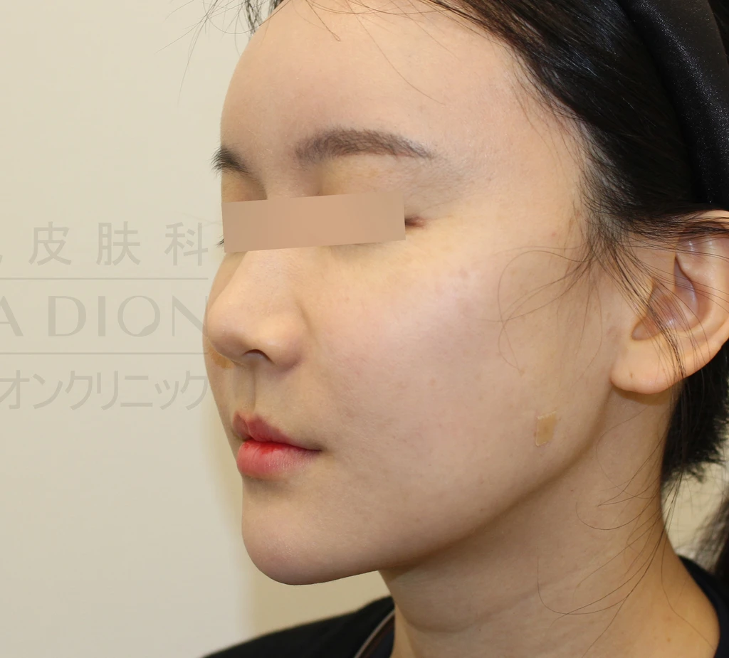 before_image