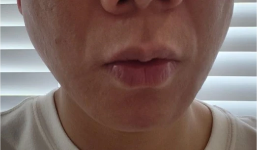 before_image