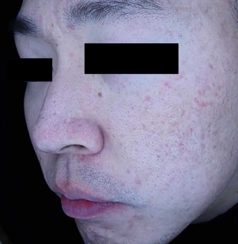 before_image