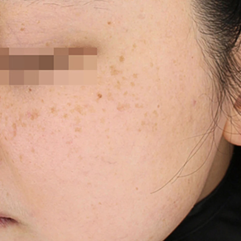 before_image