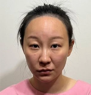 before_image