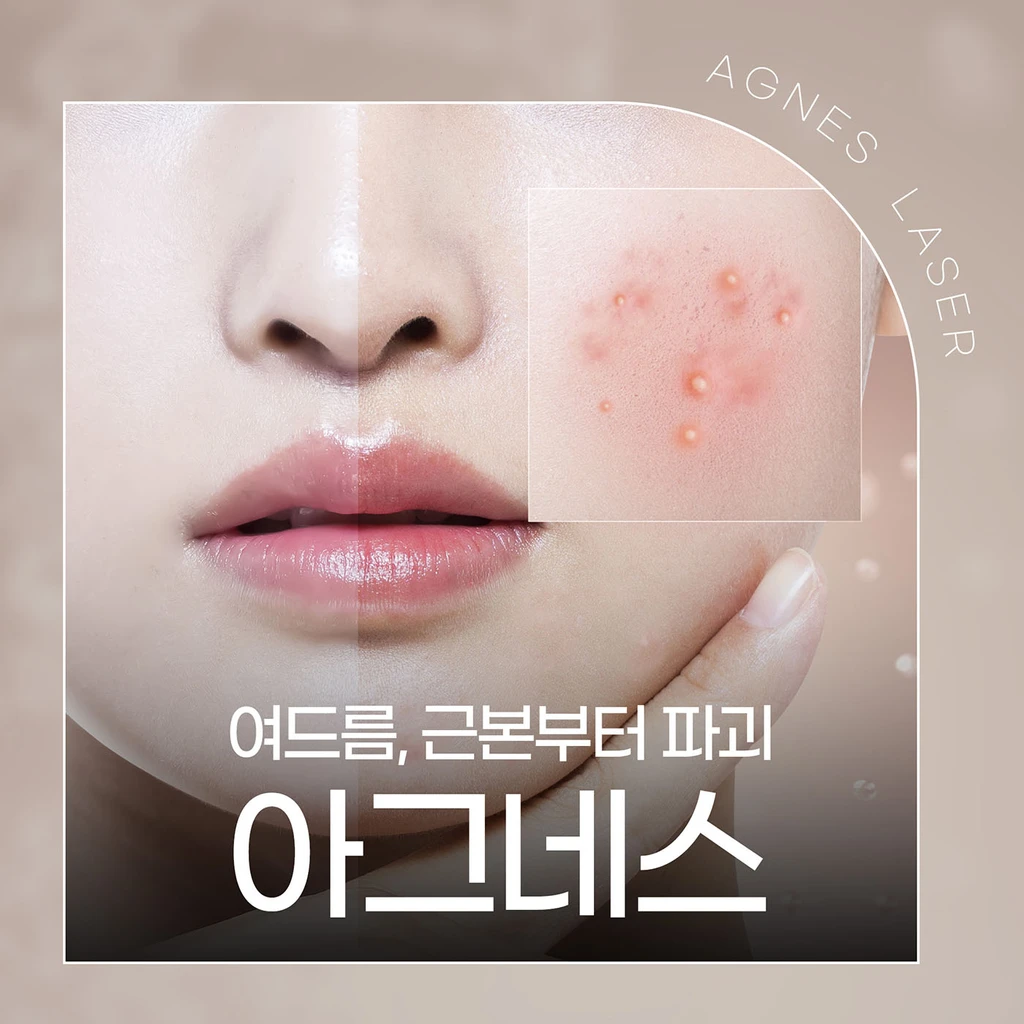 event thumbnail image