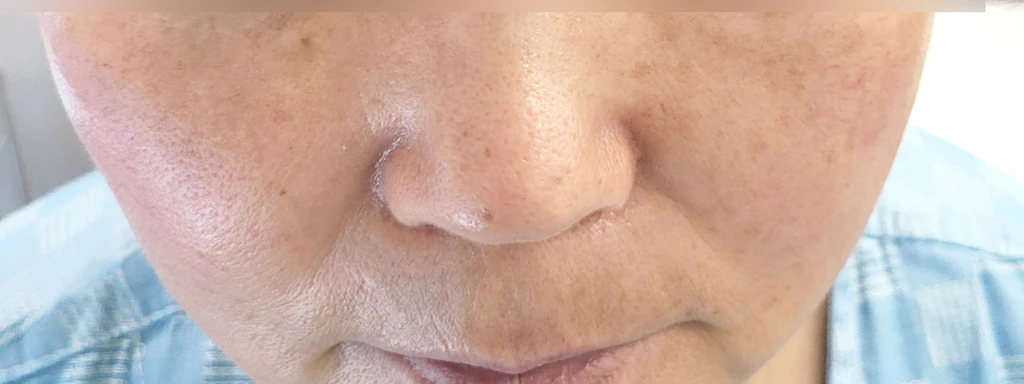 before_image