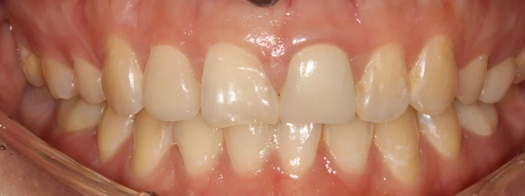before_image