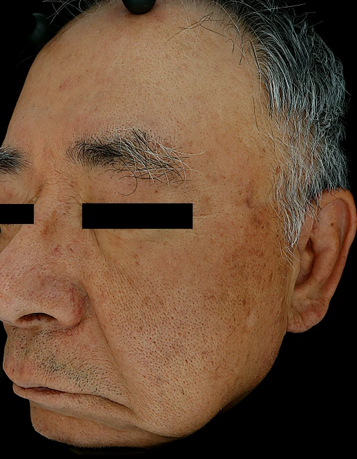 before_image