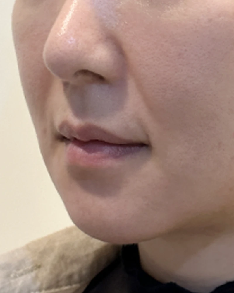 before_image