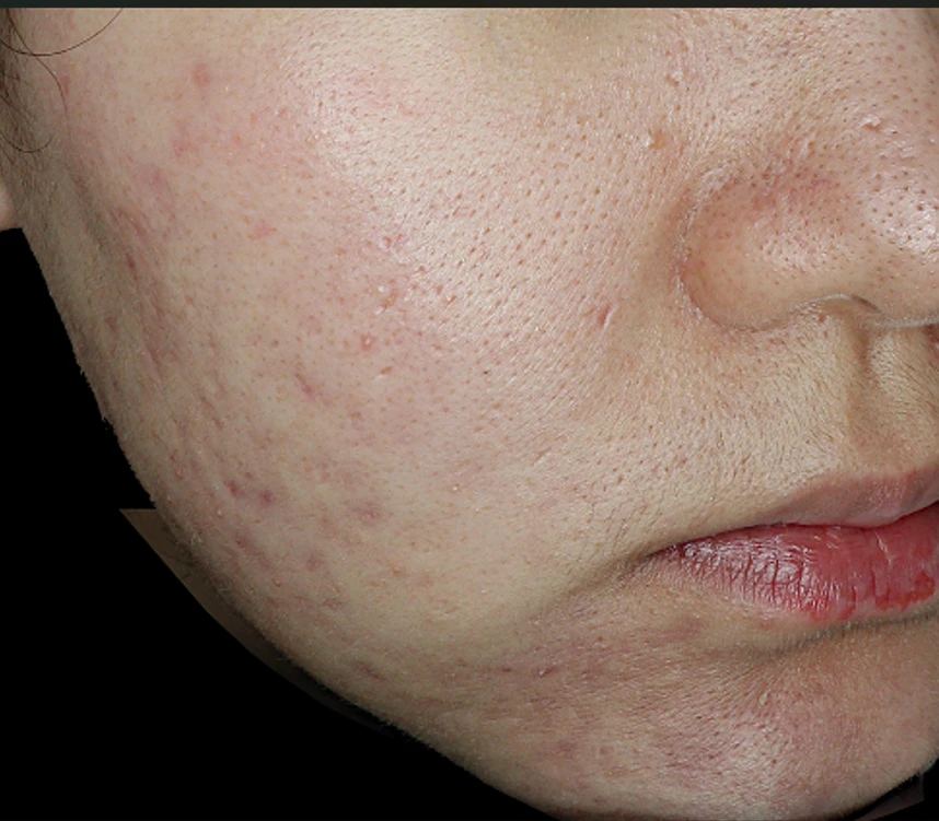 before_image