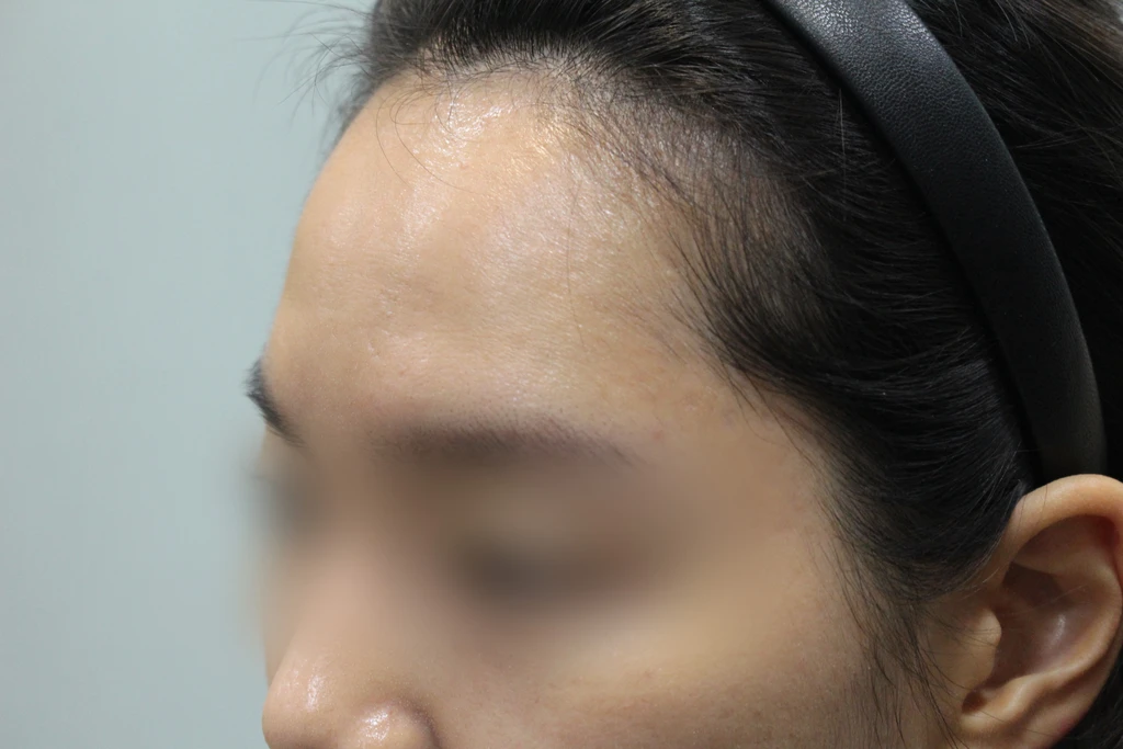 before_image