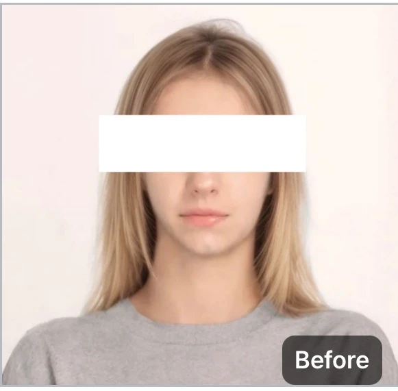 before_image