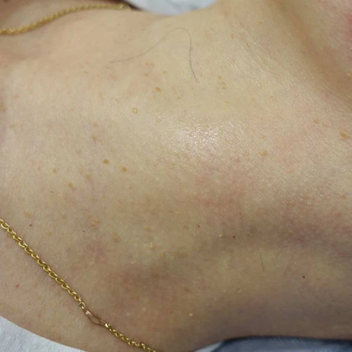 before_image