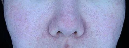 before_image