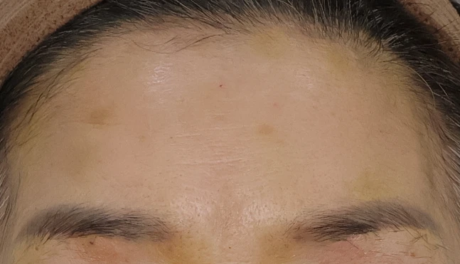 before_image