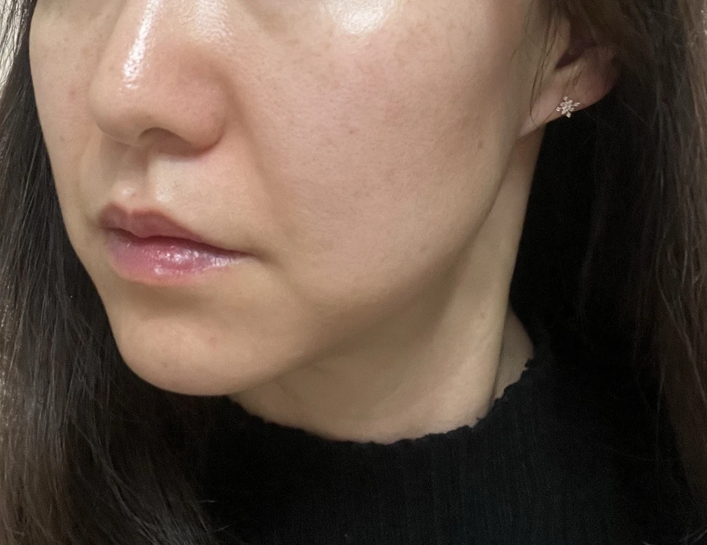 before_image