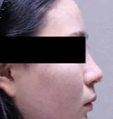 before_image