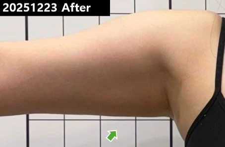 before_image