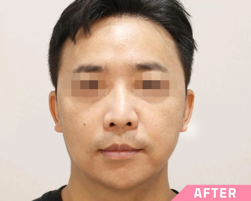 before_image