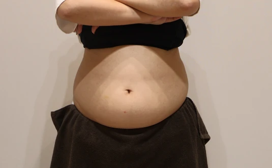 before_image