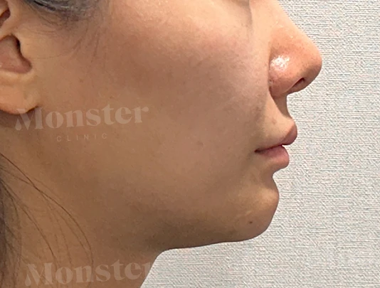before_image