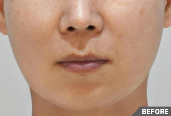 before_image