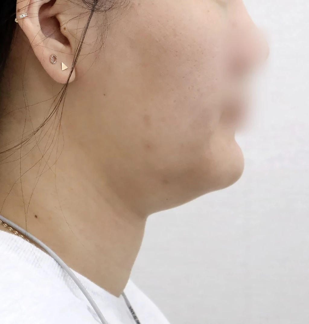 before_image