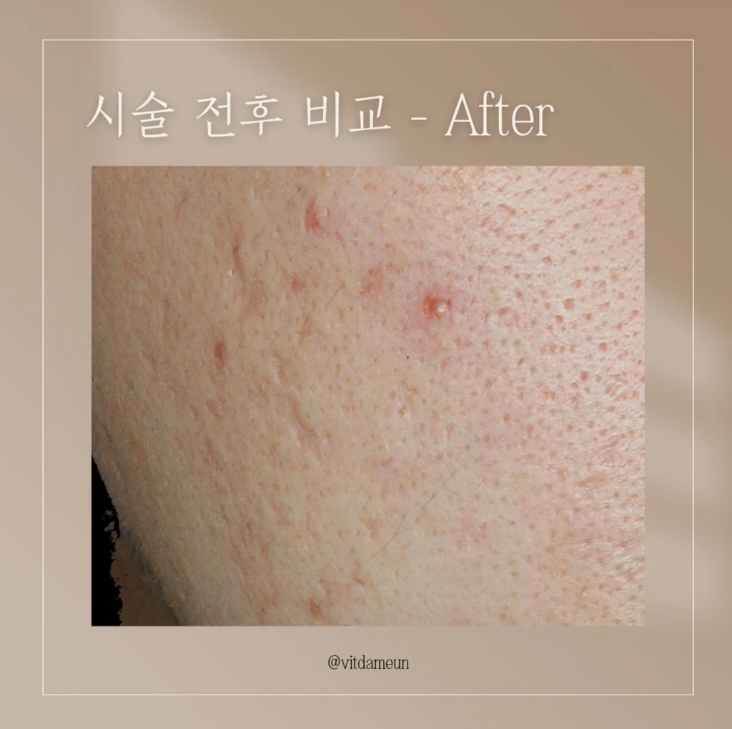 before_image