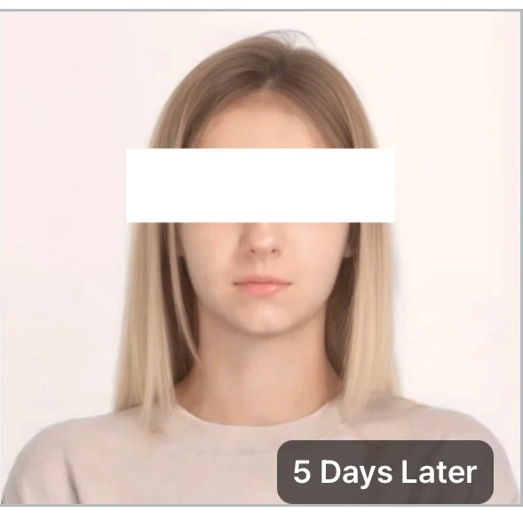 before_image