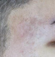 before_image
