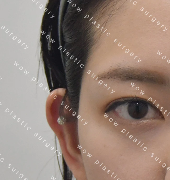 before_image