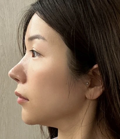 before_image
