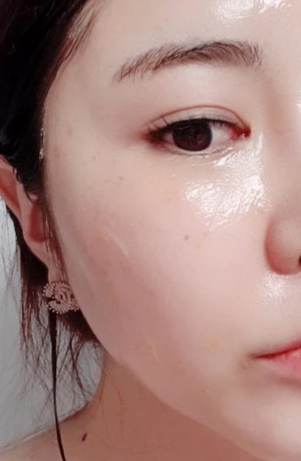 before_image
