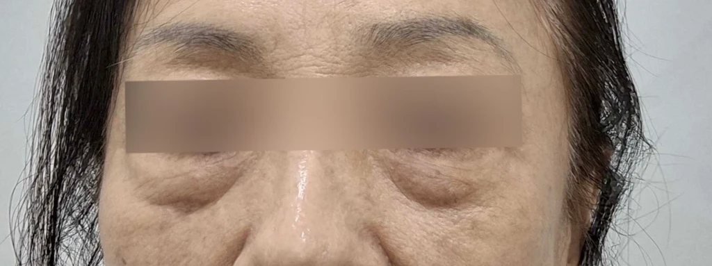 before_image