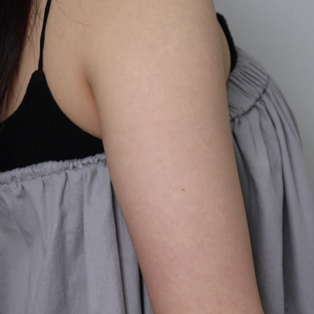 before_image